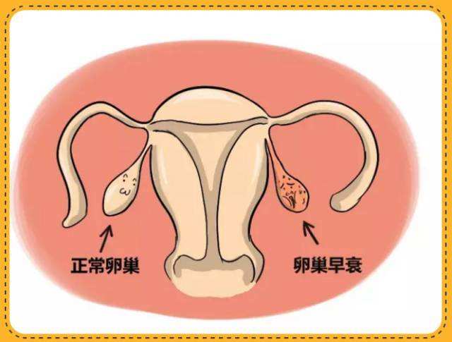 卵巢早衰导致不孕不育中医提醒女性月经紊乱潮热多汗需警惕