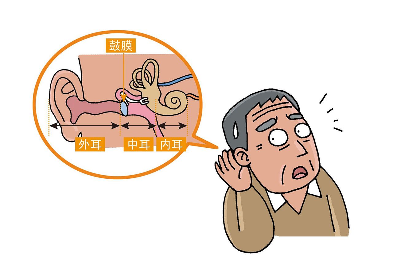 一、中医治疗耳鸣耳聋