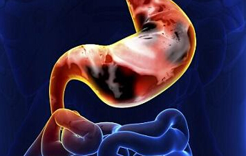 慢性胃炎老是胃痛胃胀中医怎么治疗？