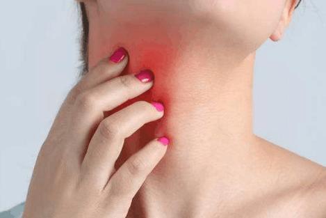 颈部皮肤癣是什么病涂什么药膏比较好？