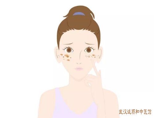武汉街道口中医皮肤科门诊：黄褐斑面部皮疹脸色发黑怎么治疗？