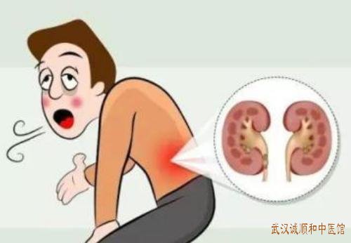 武汉地铁黄金口厉害的中医内科专家：腰酸楚乏力反复感冒时自汗出怎么治？