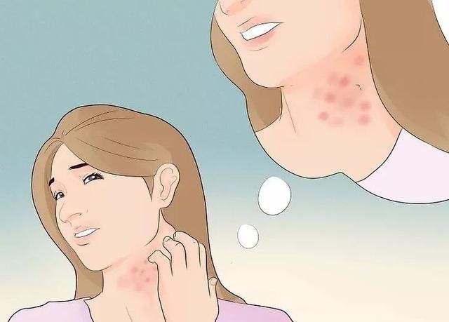 一、皮肤瘙痒症的具体表现有哪些?
