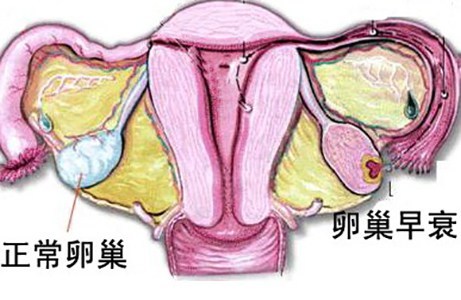 卵巢早衰经血少中医怎么调理效果好？