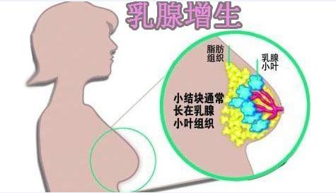 武汉治疗乳腺疾病厉害的专家推荐中医妇科廉河清中医辨治乳腺增生