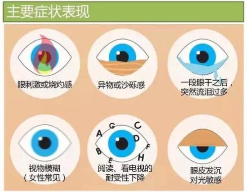 干眼症双眼干涩视物模糊中医怎么治疗效果好？名老中医柳新樵针药并用症状改善