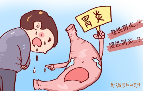 慢性浅表性胃炎伴胆汁反流中医治疗医案