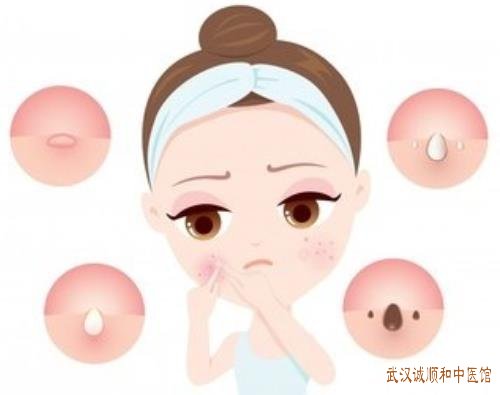 皮肤科王儒英评论：面双颊皮肤出现少许扁平疣吃中药能治好吗?