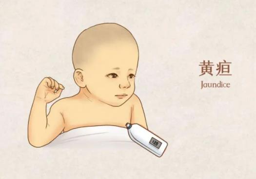 中医对于黄疸的辨证论治方法和历代名家的经验概述及西医的认识