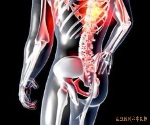 武汉诚顺和中医疼痛科柳新樵：腰部酸困腰椎间盘膨出下肢无力吃中药能治吗?