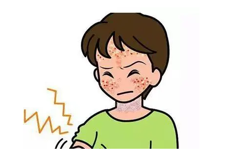 结节性痒疹