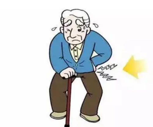强直性脊柱炎