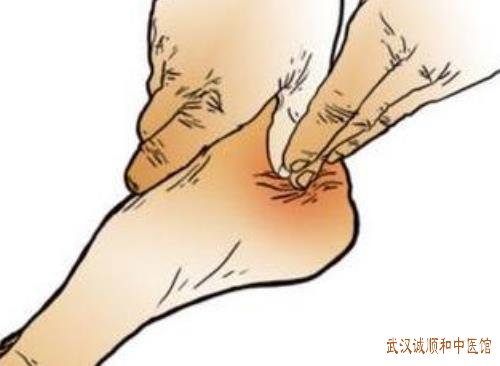足跟痛长时间站立行走脚后跟疼痛中医有哪些方法治疗效果好？