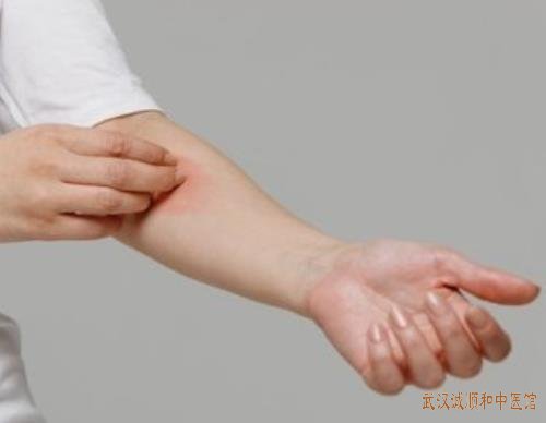 武汉中南路有名老中医：气虚血瘀型腕管综合征中医如何用药治疗?