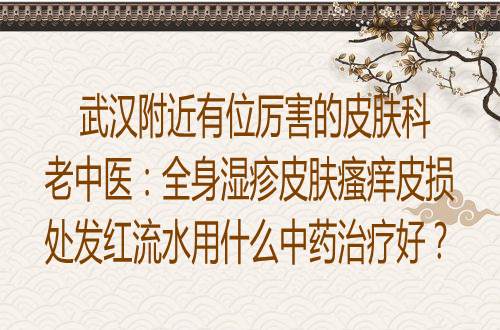 武汉附近有位厉害的皮肤科老中医：全身湿疹皮肤瘙痒皮损处发红流水用什么中药治疗好？