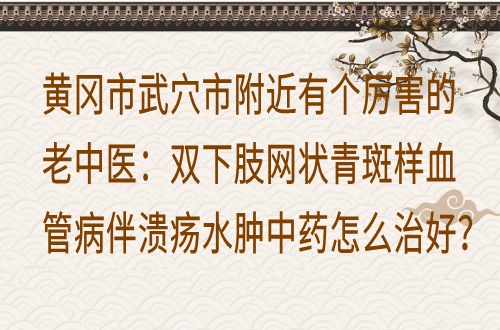 黄冈市武穴市附近有个厉害的老中医：双下肢网状青斑样血管病伴溃疡水肿中药怎么治好？