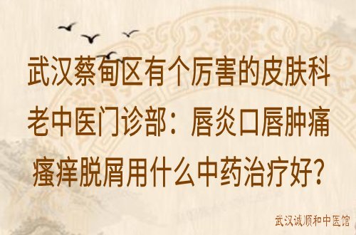 武汉蔡甸区有个厉害的皮肤科老中医门诊部：唇炎口唇肿痛瘙痒脱屑用什么中药治疗好？