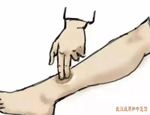 武汉地铁光谷广场站内科中医门诊：双下肢水肿各项检查未见异常伴头胀腰胀是怎么回事？