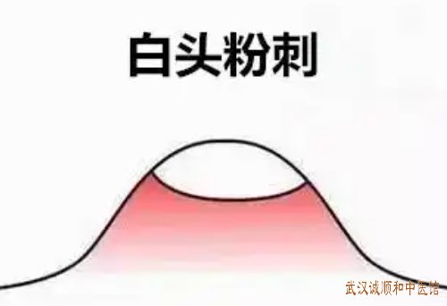 武汉武昌区皮肤病老中医门诊部：中年女性额部生白头粉刺面色晦暗用什么中药方能治好？