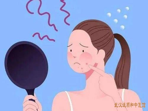 武汉珞狮南路附近看皮肤病有名的老中医：中青年脸上长痤疮中医怎么辨证治疗有效?