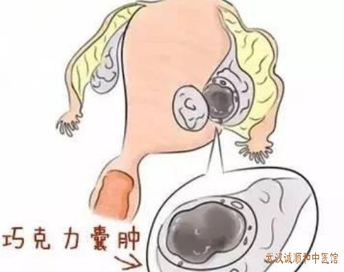 武汉中南路有位厉害的妇科老中医:中年女性月经逾期未潮2个月下腹隐痛潮热怎么治?
