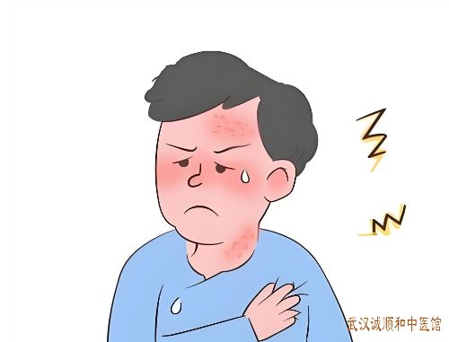 武汉专业治疗皮肤病的医院:35岁成年人结节性痒疹四肢伸侧绿豆大小半球形结节怎么治?