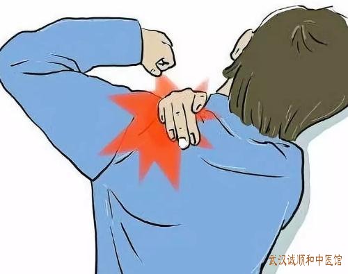 武汉看疼痛病的中医专家有哪些?中年人肩部刺痛固定活动受限伴随着疼痛加重怎么调好?