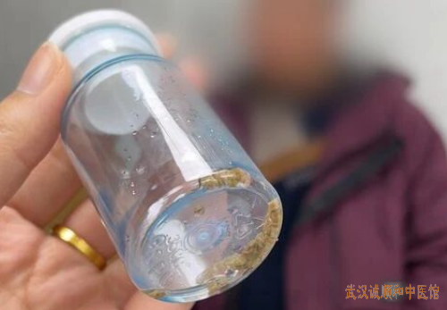 武汉有位“扫地僧”，简单方子治“怪病”！结石、结节、痛风、肿瘤……祸根竟然是它！