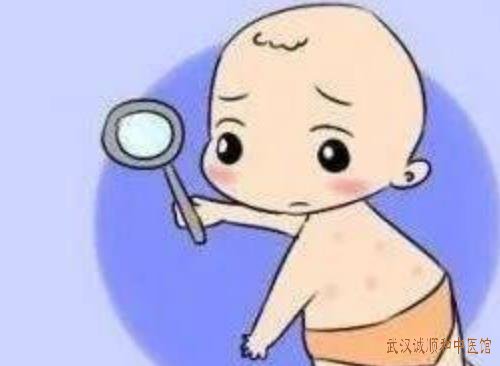 武汉看湿疹好点的医院医生：婴儿反复起红疹瘙痒难耐伴有食欲不振中医怎么辨证治疗？