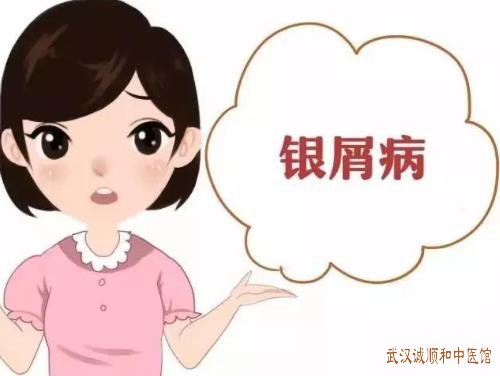 武汉中医看小儿银屑病专家哪家好？小儿得了银屑病1年皮肤干裂粗糙伴便秘怎么办呢？